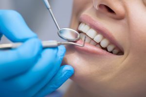 dental checkups with our Kingwood dentist