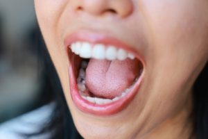 woman opening her mouth