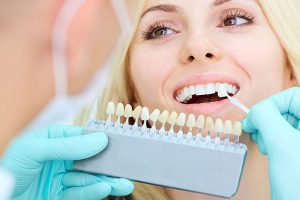 woman getting porcelain veneer samples 