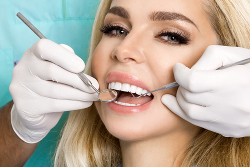 veneers